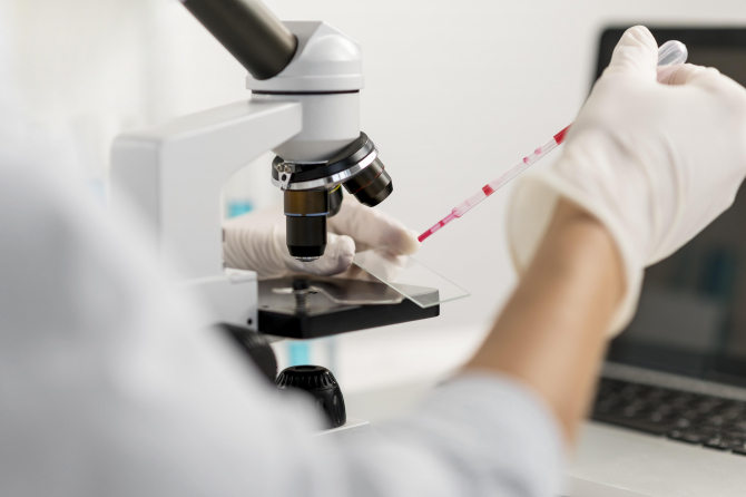 Cercetătorii români au creat un test PCR capabil să identifice atât tulpina, cât și în ce stadiu este boala
